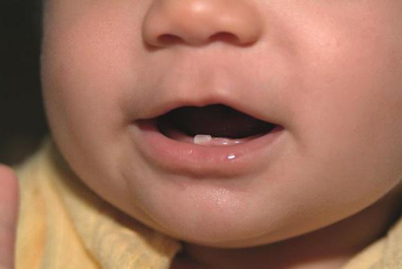 Как отличить молочный зуб от коренного?