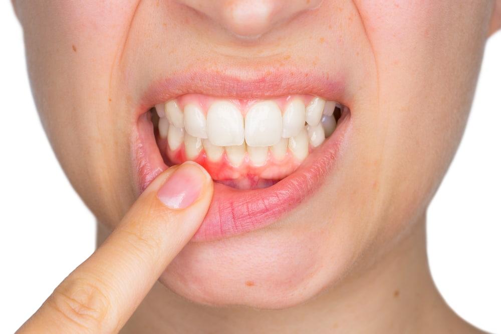 Болит зуб домашние методы