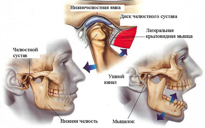 Воспаление челюстно лицевого сустава симптомы лечение