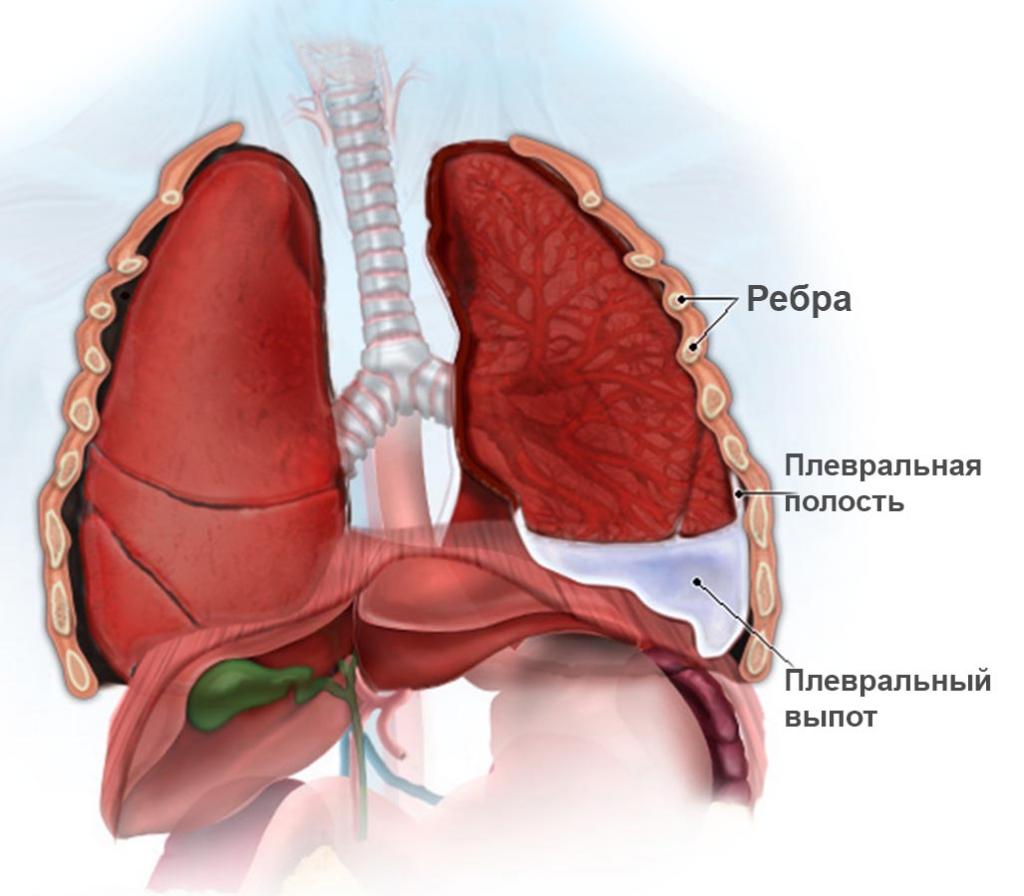 Что такое плевра легких?
