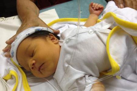 ядерная желтуха новорожденных симптомы