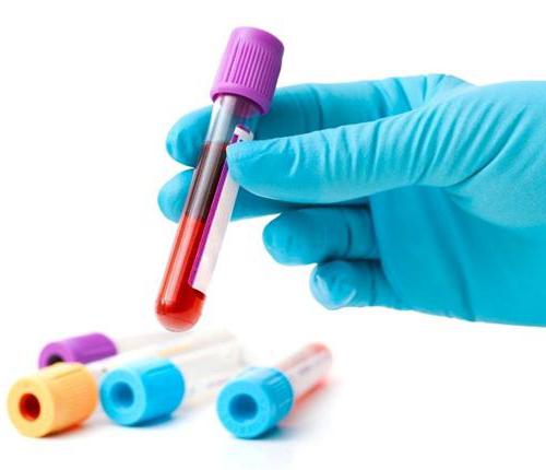 Анализ крови на ВИЧ расшифровка