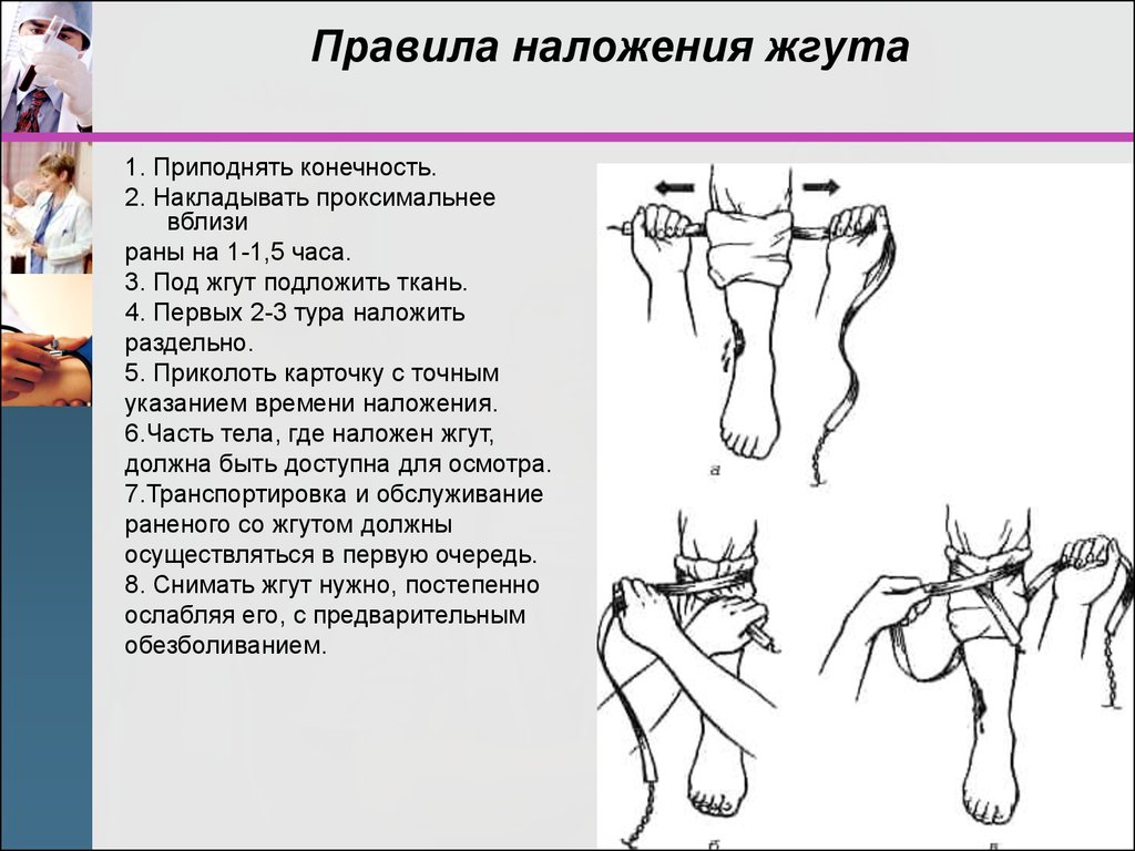 Пальцевое прижатие сонной артерии