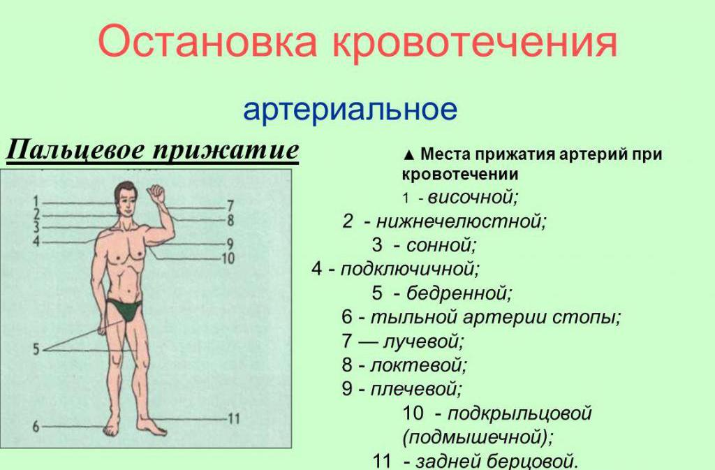 Рисунок названием артерий и костей к которым осуществляется прижатие артерии при кровотечении