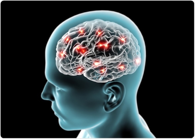 Энцефалопатия головного мозга лечение народными средствами