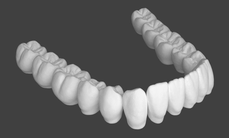 Анатомическое строение зубов нижней челюсти.