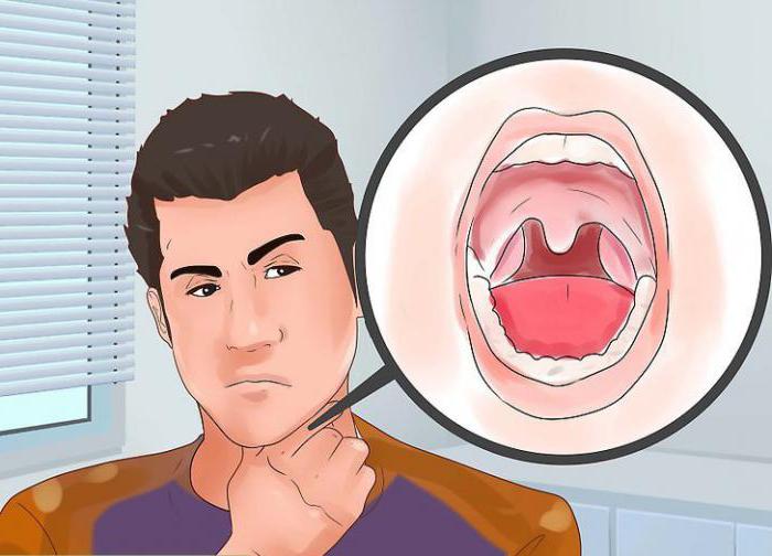 Как вылечить запах изо рта от горла thumbnail