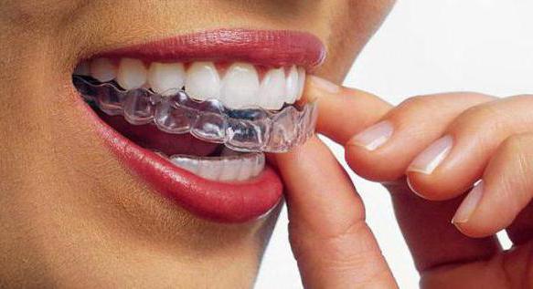 ортодонтия в стоматологии