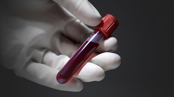 подготовка пациента к сдаче биохимического анализа крови 