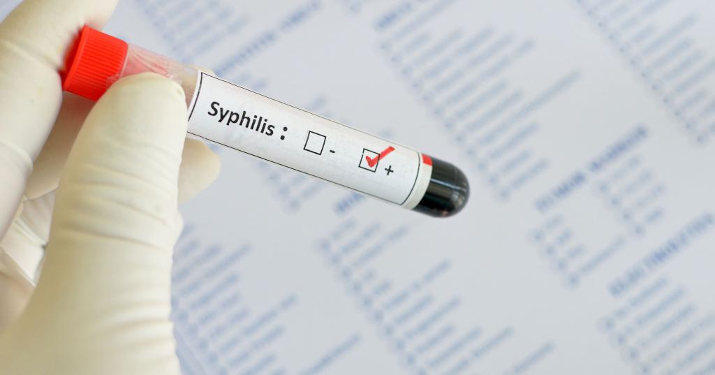 признаки врожденного сифилиса