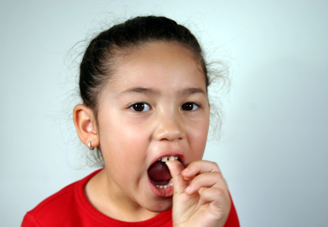Сильно шатается молочный зуб у ребенка