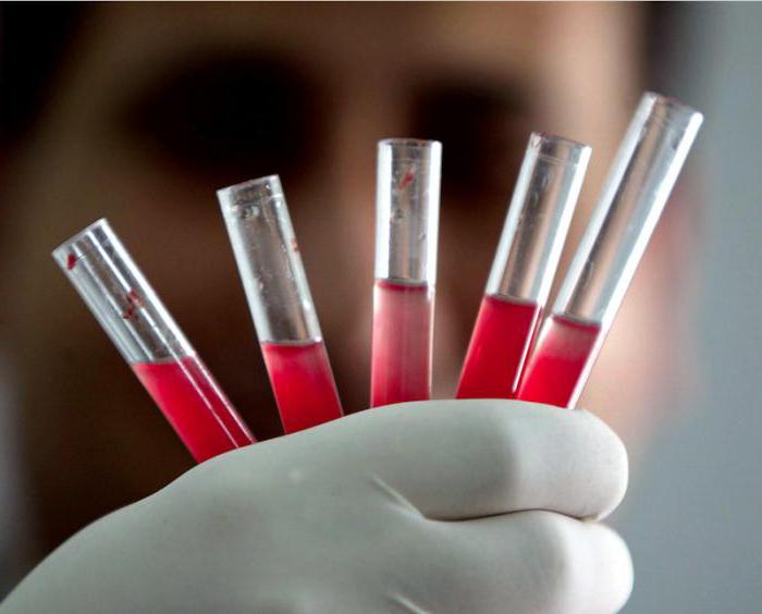 Что определяет клинический анализ крови из вены thumbnail