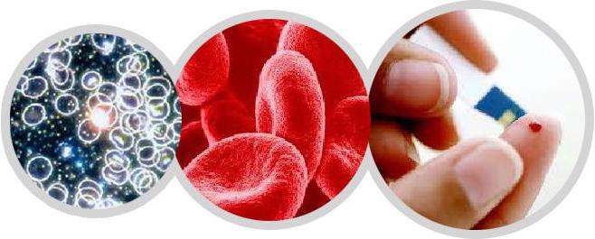 Какие заболевания может показать клинический анализ крови thumbnail
