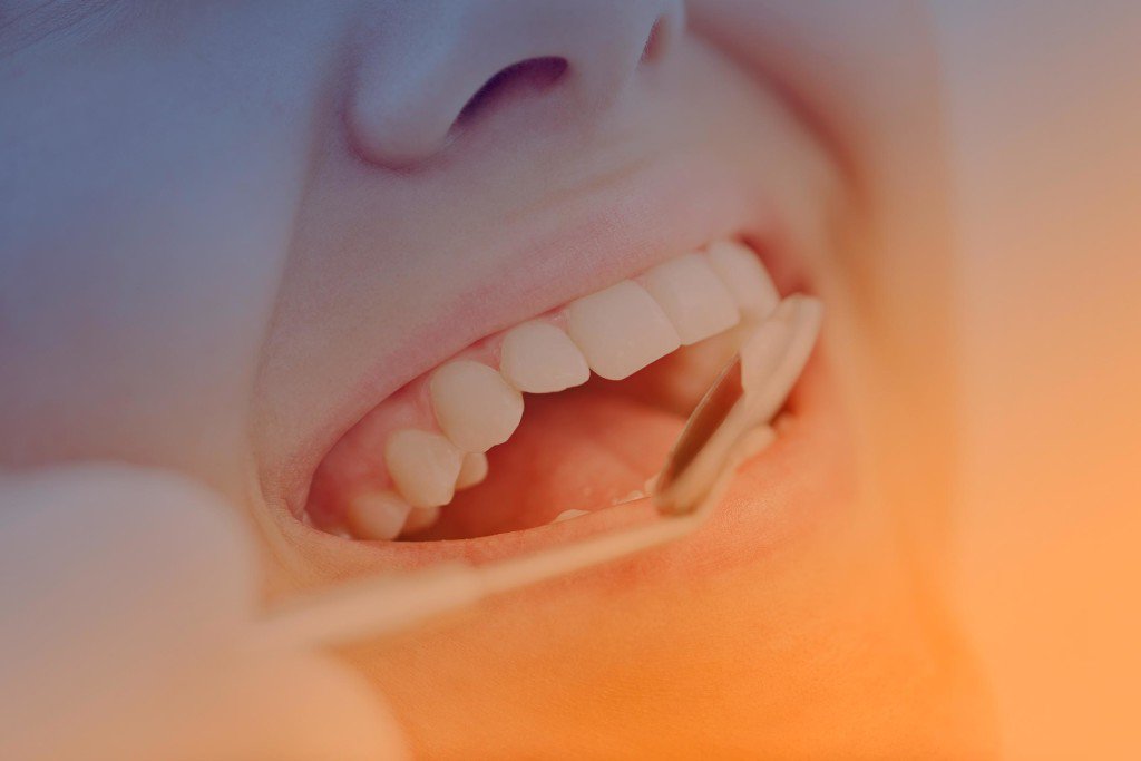 Хлоргексидин после удаления зуба: показания, правила применения