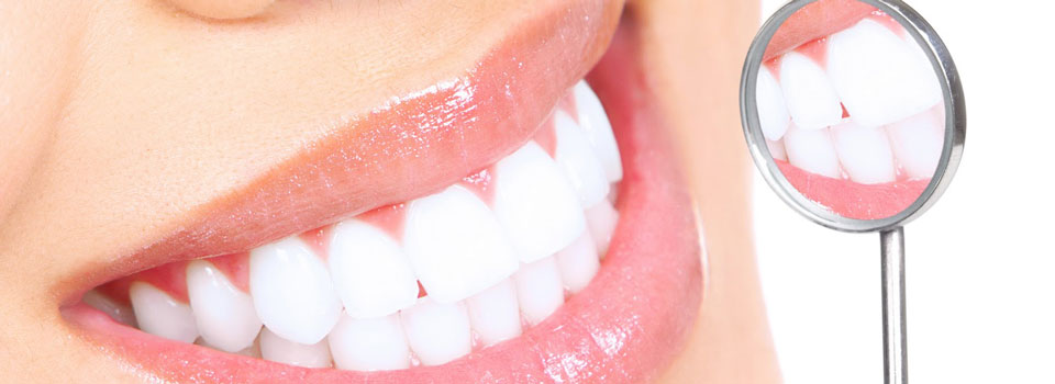 отбеливание зубов у стоматолога