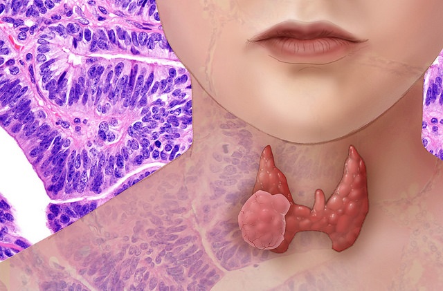 thyroid function screening