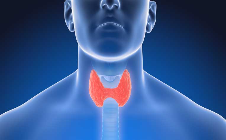 thyroid screening analysis