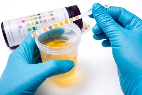 elevated white blood cells and protein in the urine