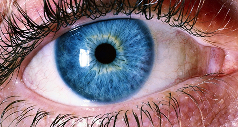 расслоение сетчатки глаза симптомы