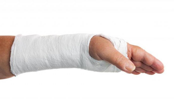 Опухоль руки после перелома в гипсе thumbnail
