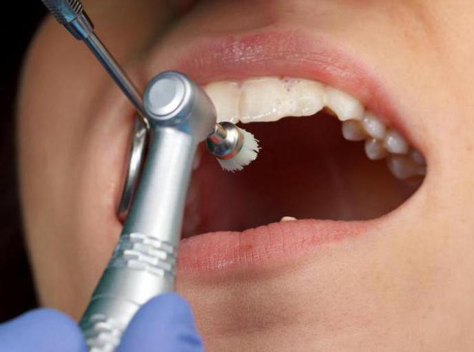 гипоплазия эмали зубов у детей лечение 