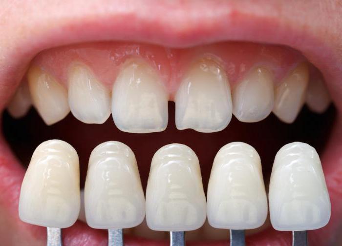 гипоплазия эмали зубов наследуется как сцепленный 