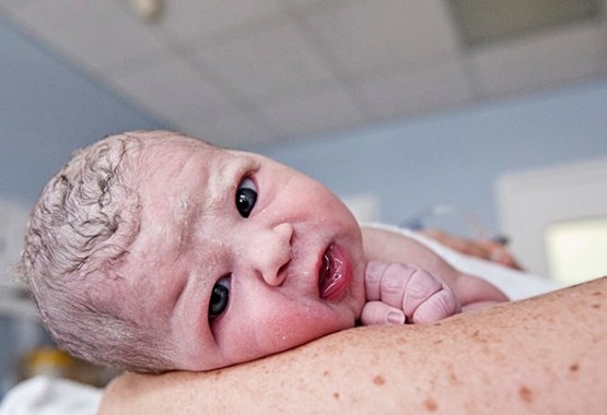 Псевдофурункулез новорожденных фото