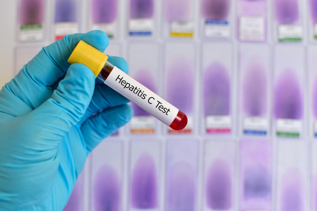 гепатит с 1 генотип можно ли вылечить