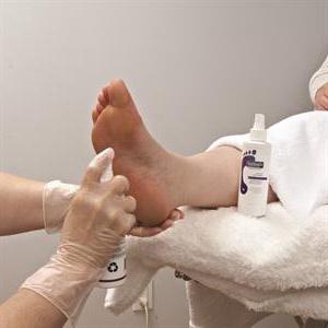 Натоптыши на больших пальцах ног лечение народными средствами thumbnail