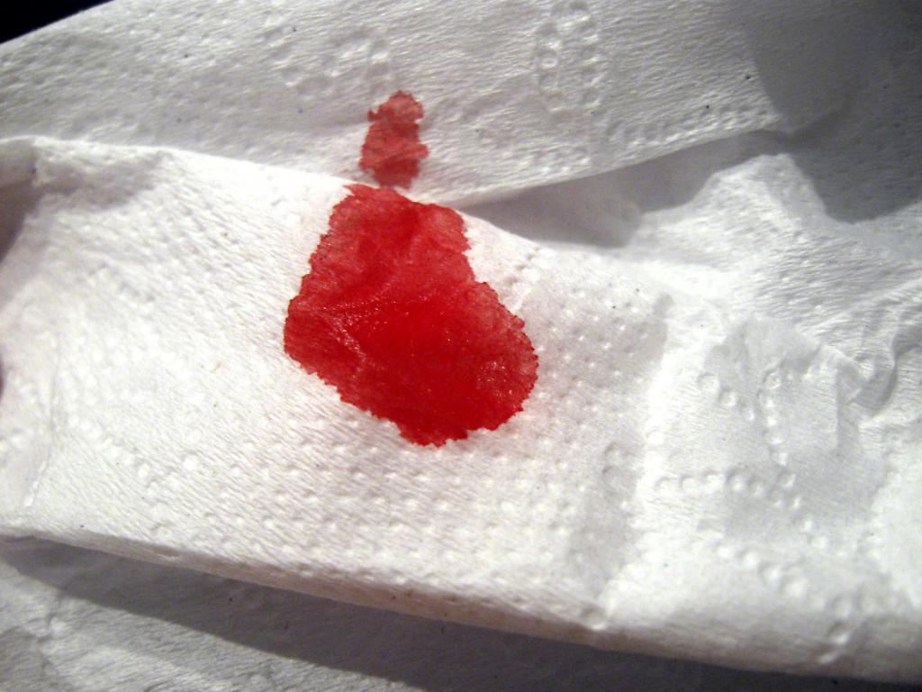 Blood on toilet paper