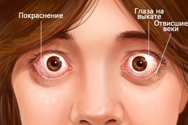 Глазной симптом