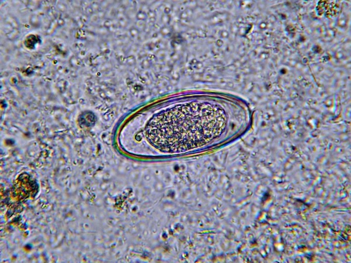 Яйца остриц под микроскопом