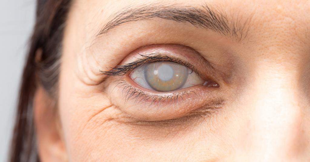 Удаление катаракты в пожилом возрасте: последствия, реабилитационный период, возможные осложнения