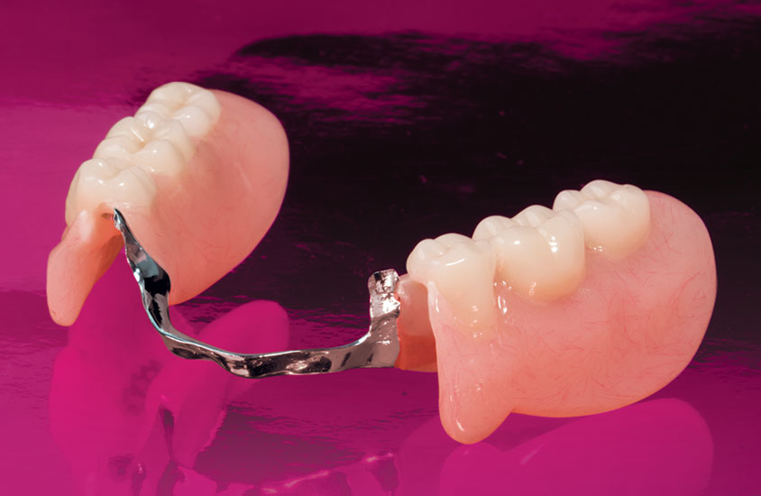 Уход за зубными протезами съемными