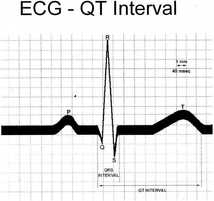 синдром удлиненного интервала qt лечение