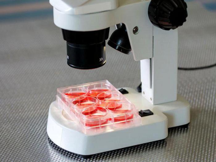 Почему в анализе крови много лейкоцитов thumbnail