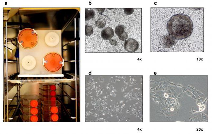 stages of development of radiobiology