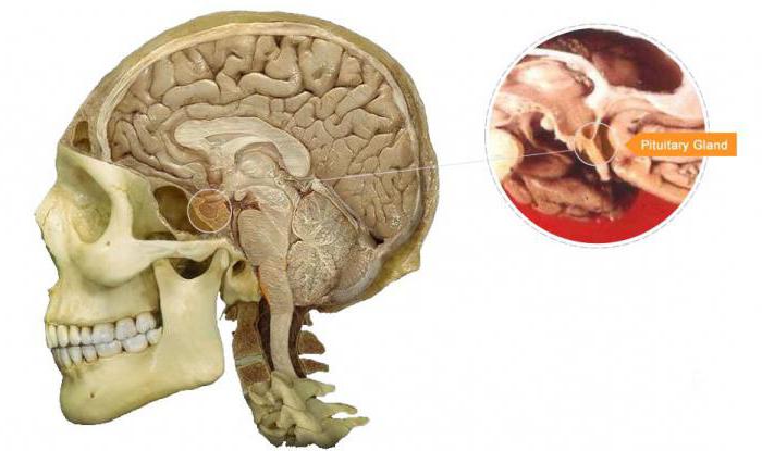 bazedova disease of the pituitary gland