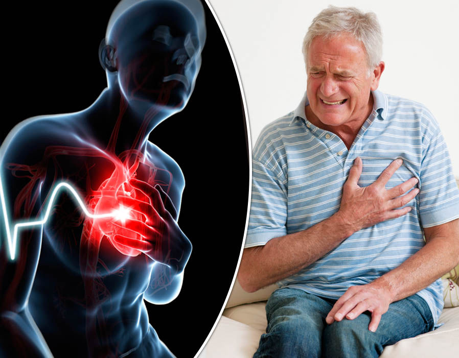 признаки инфаркта миокарда
