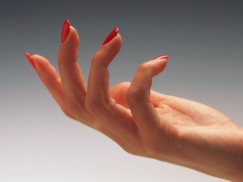 перелом пальца на руке