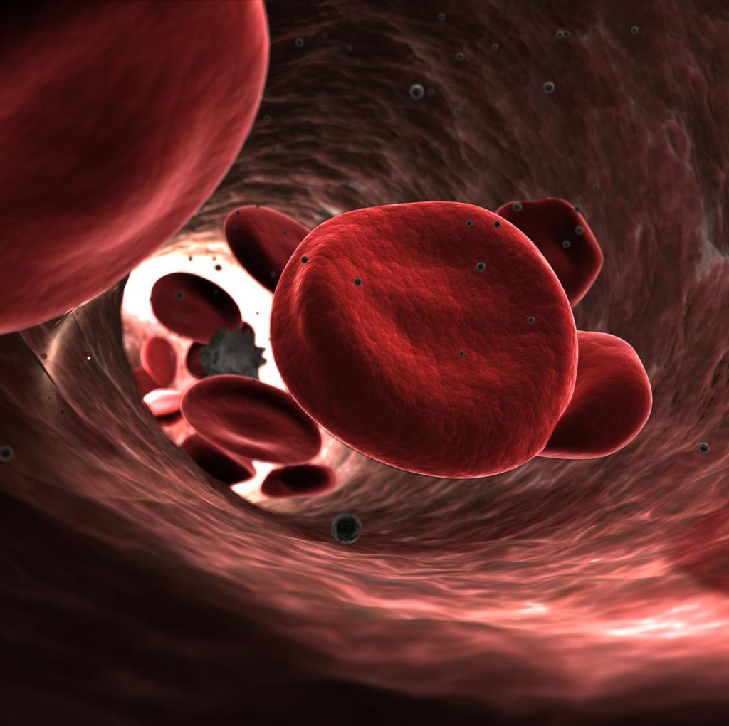 primary stage myelofibrosis