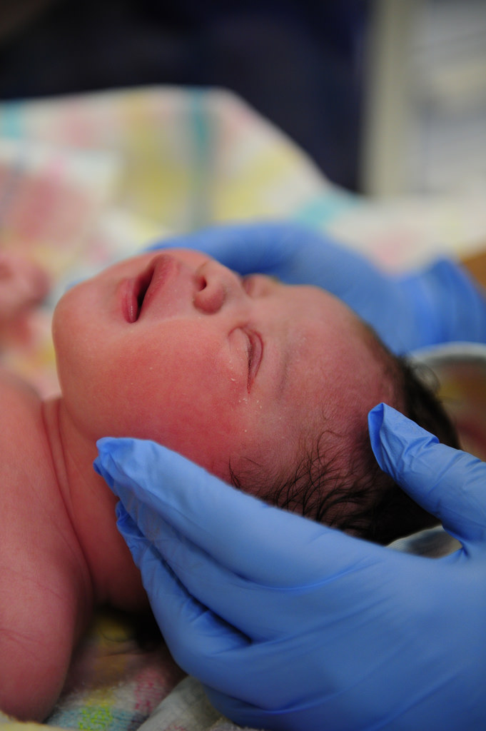 родовая опухоль появляется у новорожденных