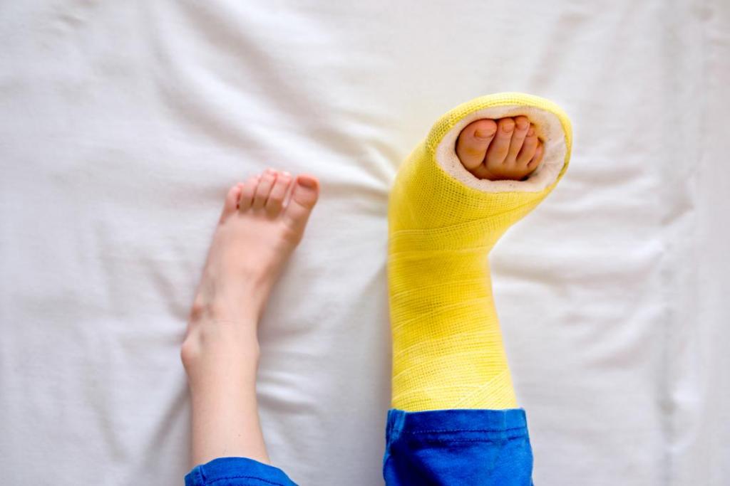 Перелом ноги у детей фото