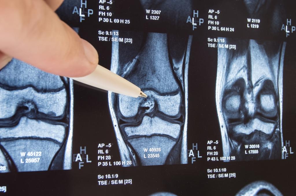 сделать рентген коленного сустава