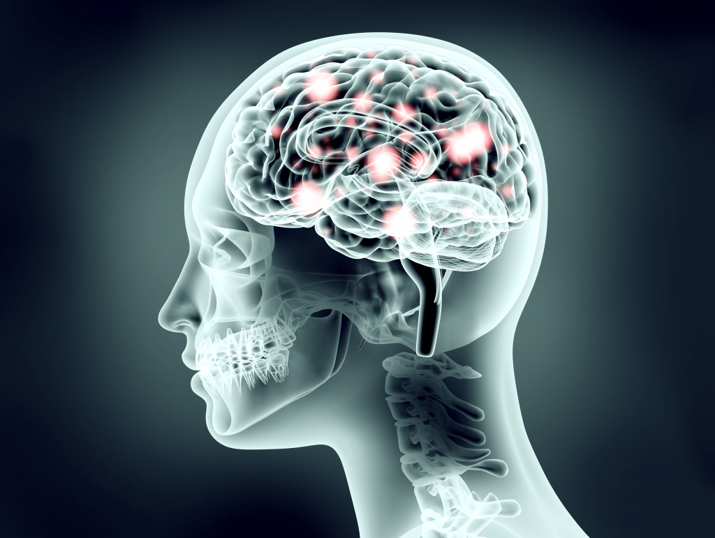 посттравматическая энцефалопатия головного мозга 