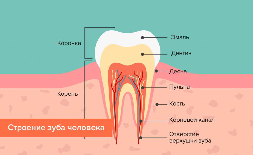 пришеечный кариес лечение