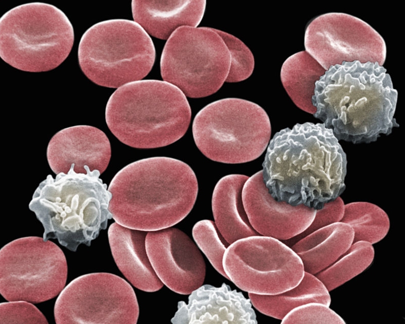 лейкоциты клетки крови