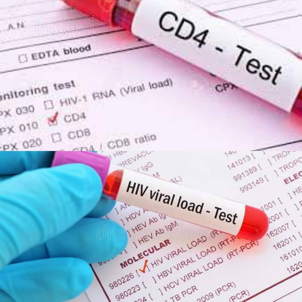 cd4 and hiv lymphocytes