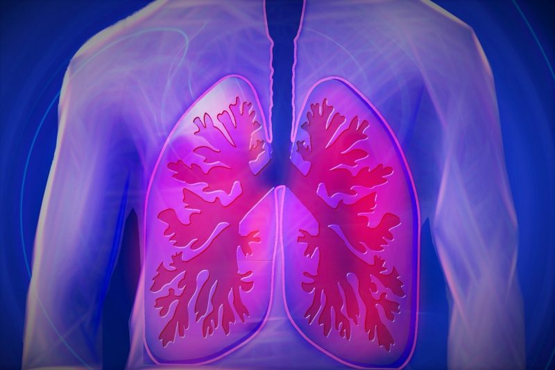 синдром острой дыхательной недостаточности