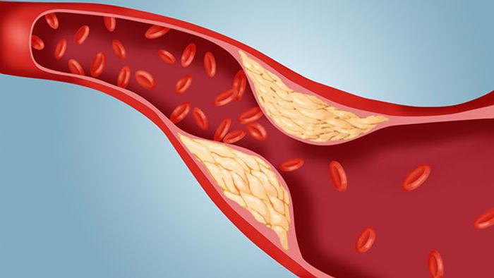 как правильно сдавать кровь на холестерин и глюкозу